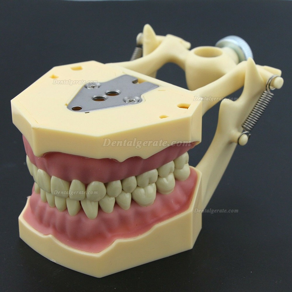Dental Typodont Restorative Standardmodell M8014-2 Kompatibel mit Frasaco AG3 Modell